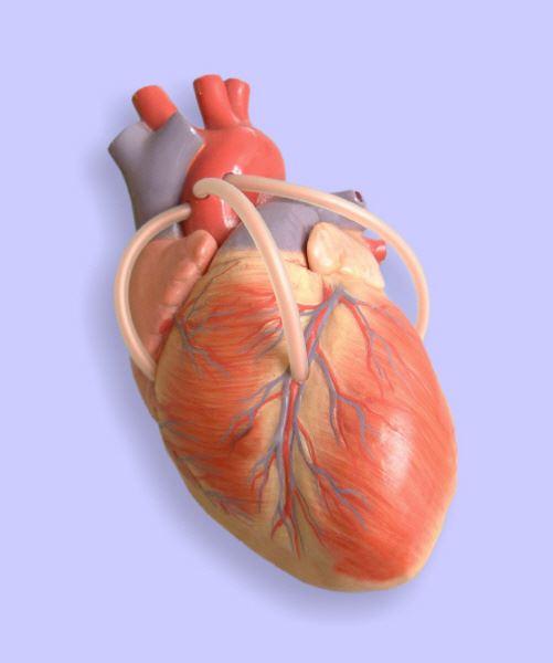 Herzmodel mit Bypassgefäßen