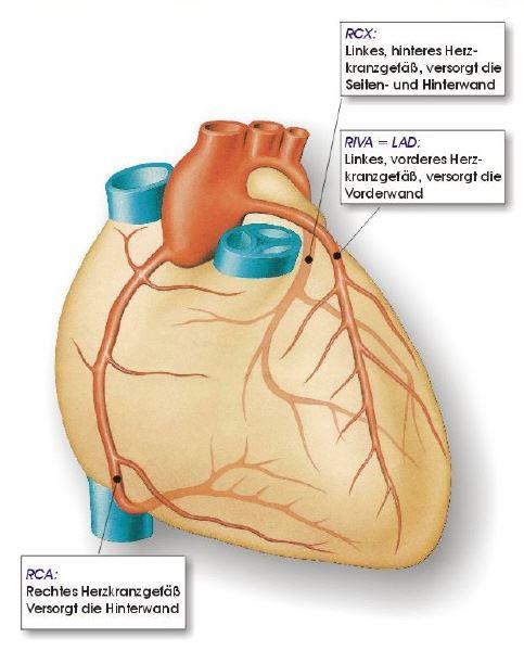 Schema der Herzkranzgefäße
